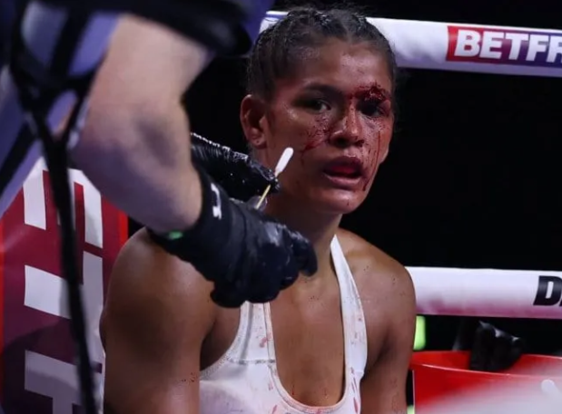 Yanina Lescano sufrió un peligroso corte en la ceja izquierda que impidió que continuara la pelea.